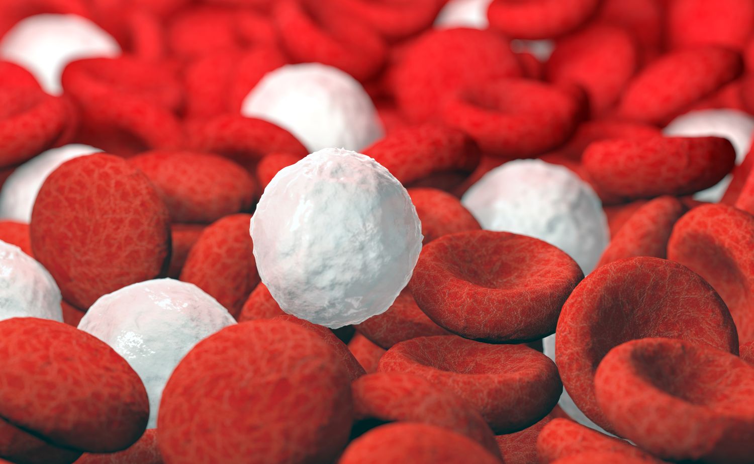 Anemia